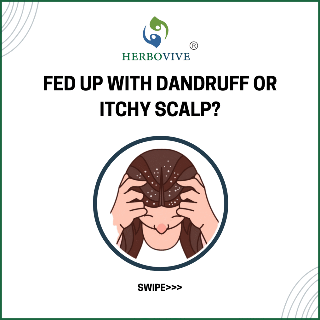 Social media carousel cover graphic for Herbobive, addressing common scalp issues: 'Fed up with dandruff or itchy scalp?' Uses a clear illustration of a person with dandruff and a 'SWIPE>>>' call to action. Demonstrates engaging content creation for health and beauty brands.